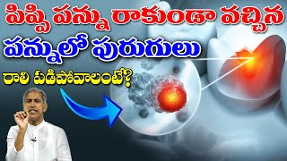 Download lagu పిప్పి పన్ను రాకుండా వచ్చిన పన్ను లో పురుగులు రాలి పడిపోవాలంటే ? | Dr Manthena Satyanarayana Raju mp3 Download lagu పిప్పి పన్ను రాకుండా వచ్చిన పన్ను లో పురుగులు రాలి పడిపోవాలంటే ? | Dr Manthena Satyanarayana Raju mp3