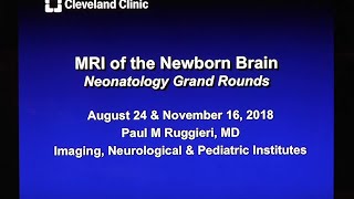 MRI of the Newborn Brain