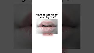 do you want to get rid for your dry lips?👄~💗#shorts#viral#lipscare #trending#glowup#fypシ#aesthetic