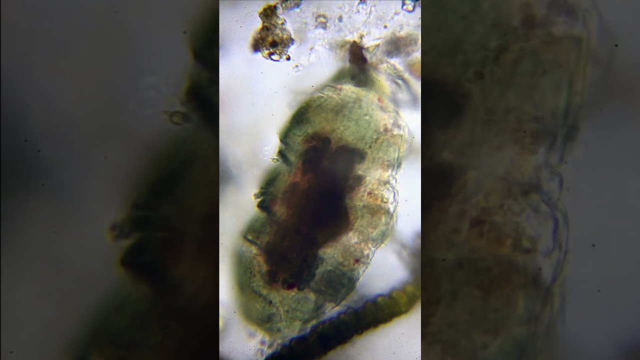 のんびり屋さんですトゲクマムシ