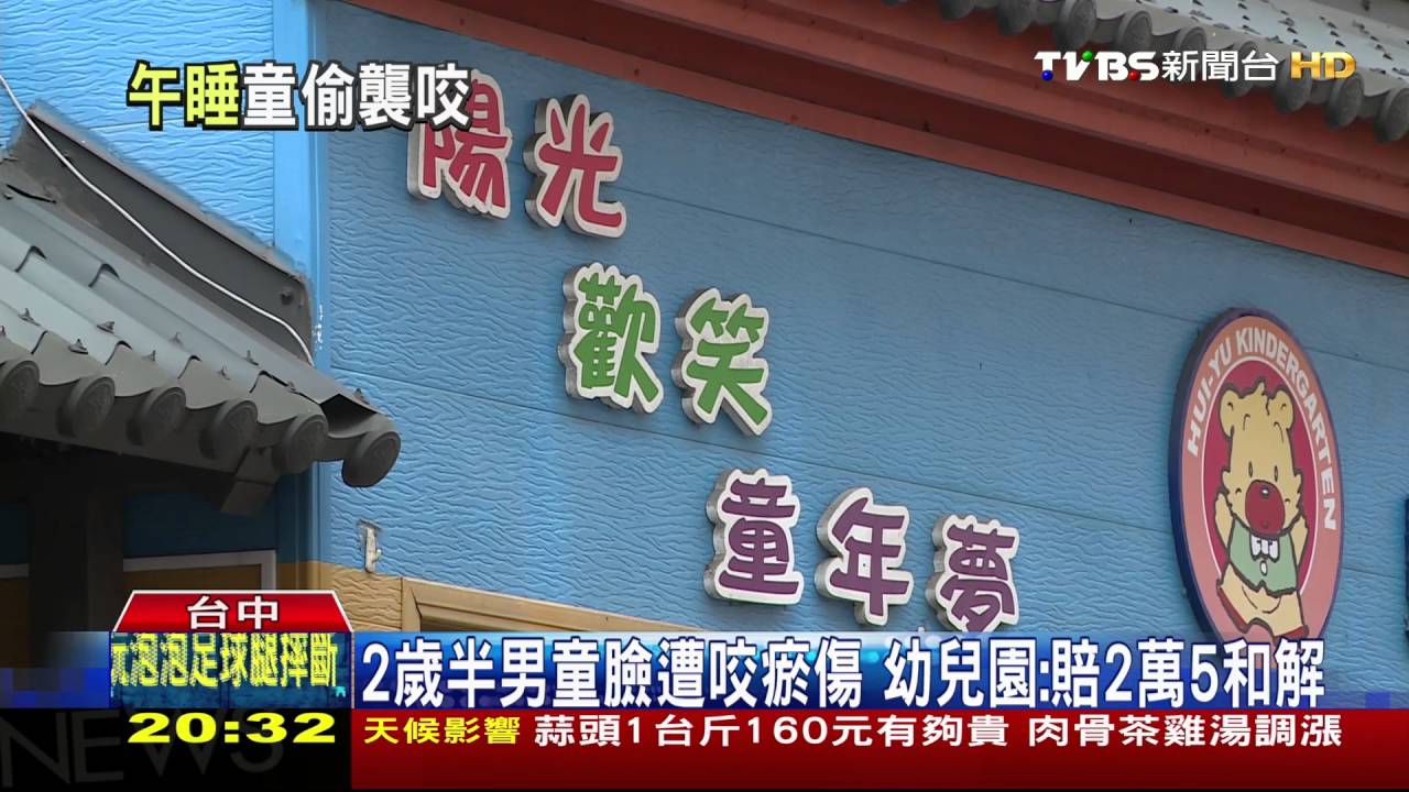 2歲半男童臉遭咬瘀傷 幼兒園:賠2萬5和解