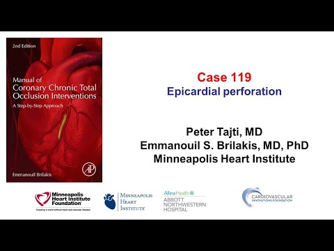 Case 119: Manual of CTO Interventions: Epicardial collateral perforation