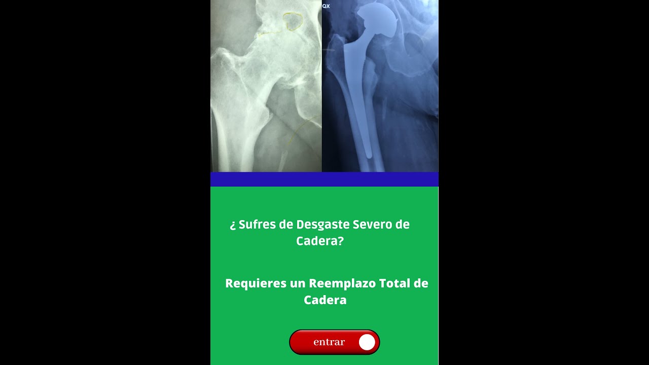 Rey Armando Cárdenas Acuña-12