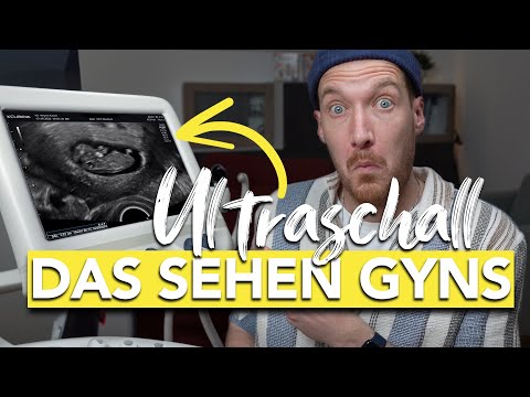 Was ist das? Ultraschall in der Schwangerschaft enträtselt I vom Embryo bis zum Baby