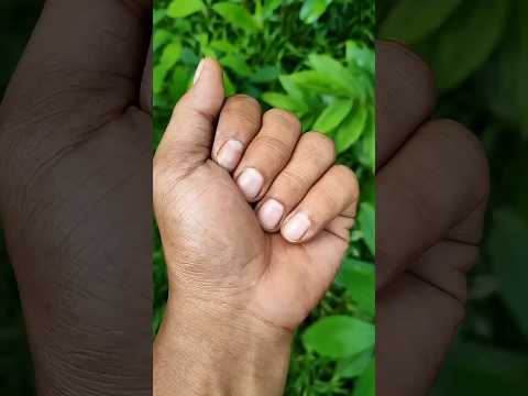 It is the Smaller shiny jewel beetle#naturepart2#beautifulinsects #anyuniqueanimals #insects