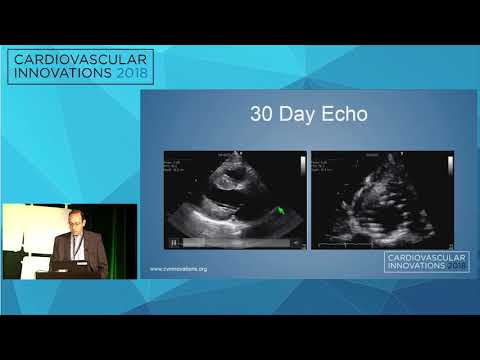 CVI2018 Session: How I managed a difficult Evolut R case - Firas Zahr, MD