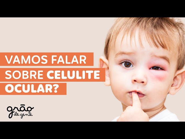 VOCÊ PRECISA VER ESSE VÍDEO SOBRE CELULITE OCULAR NO BEBÊ ❗👁️
