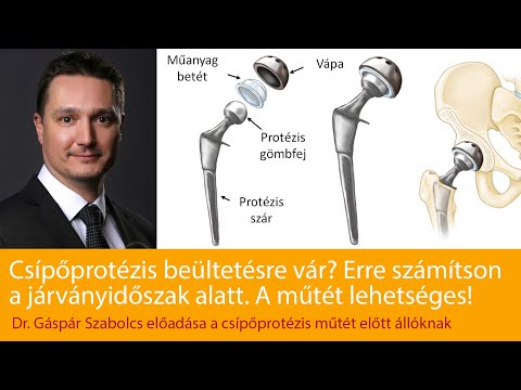 , title : 'Dr. Gáspár Szabolcs - Csípőfájdalomról és a csípőízületi protézisműtétről'