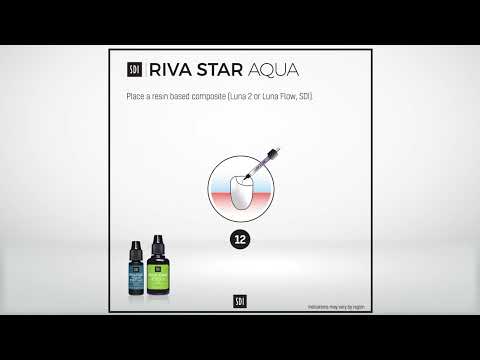 Riva Star Aqua - Sandwich technique  (Restoring tooth with GIC and Composite)