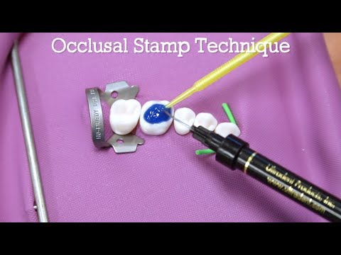 How To Do The Occlusal Stamp Technique