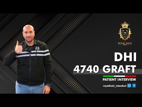 Trapianto di Capelli: Cliente Italiano al ROYAL HAIR Clinic