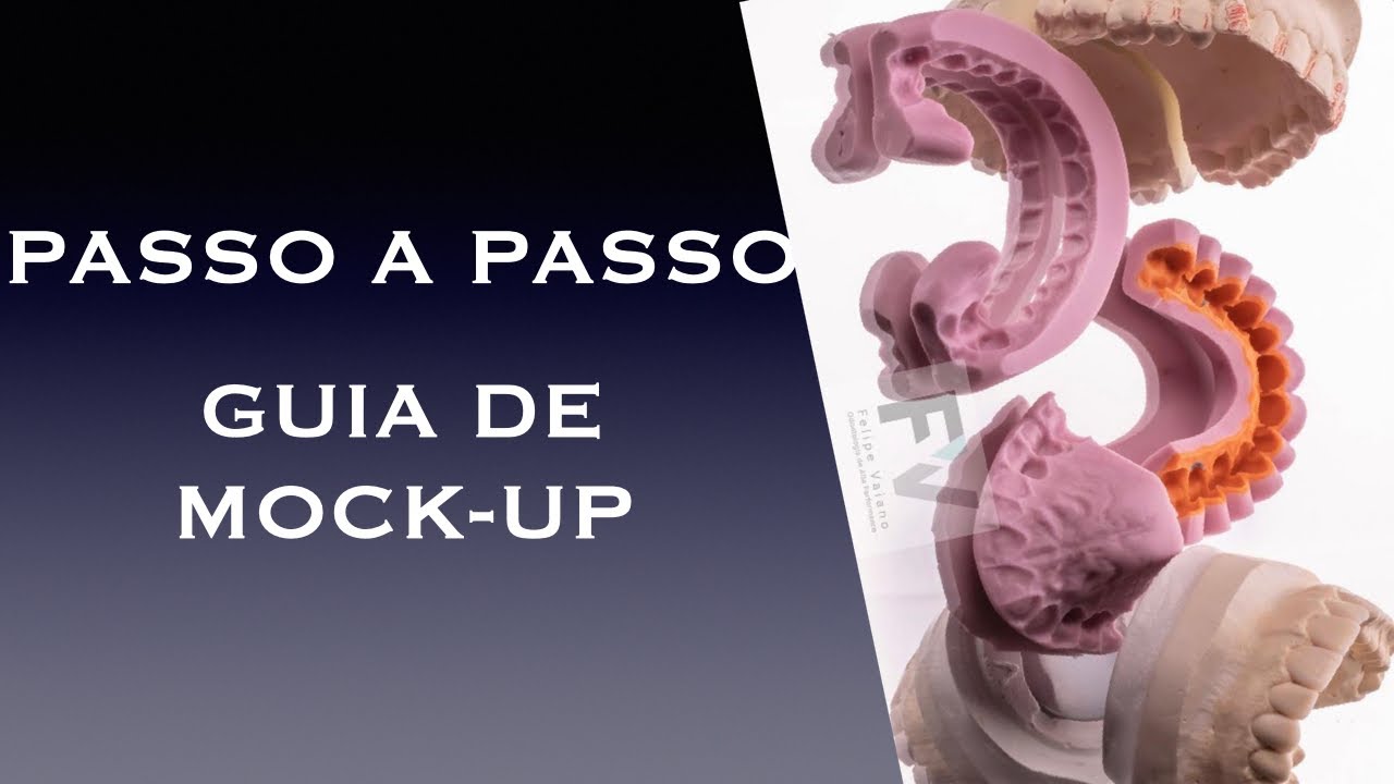 COMO FAZER A MURALHA/GUIA DE MOCK UP? por Dr. Felipe Vaiano