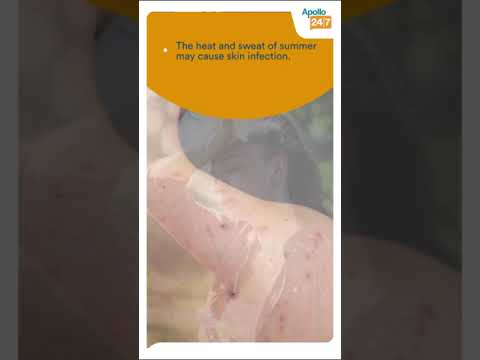 How To Deal With PCOD Acne Dr Koushik Lahiri