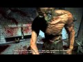 Outlast -11- Dr. Trager 