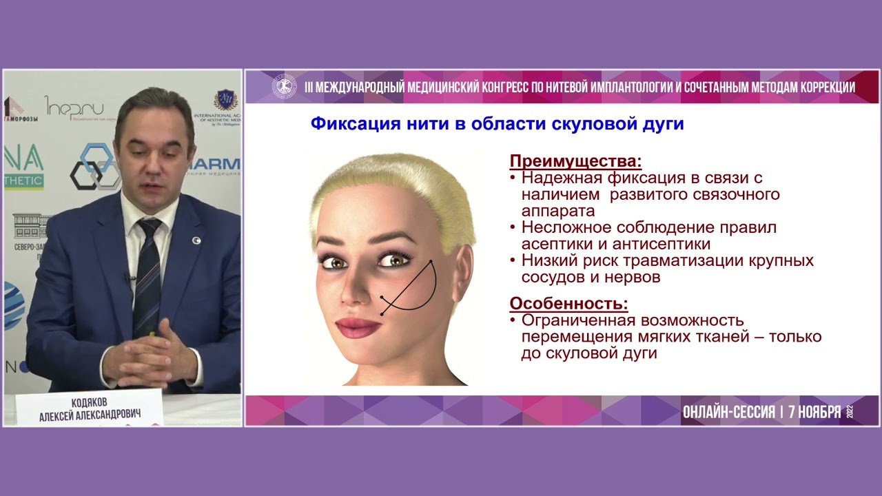 Преимущества и недостатки различных способов фиксации нитей при стандартных методиках. Доклад Кодякова А.А. | ОСМНТ Преимущества и недостатки различных способов фиксации нитей при стандартных методиках. Доклад Кодякова А.А. | ОСМНТ