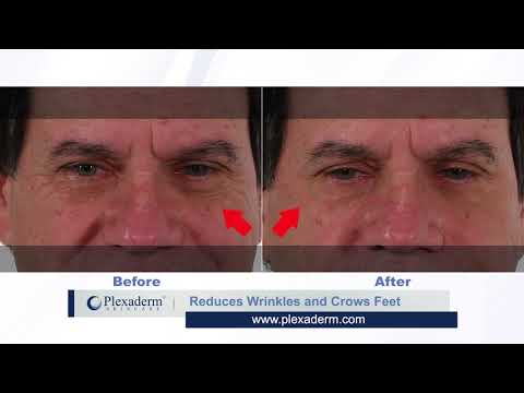 Plexaderm Works in Minutes