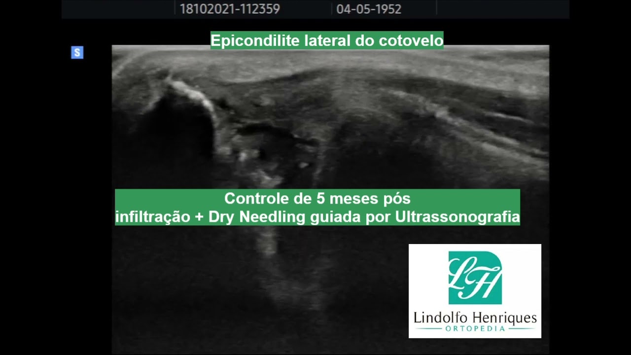 Lindolfo Henriques-16