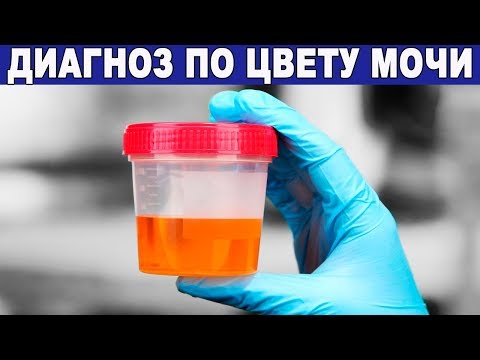 Лечение остеохондроза при противопоказании массажа Сделать узи коленного сустава челябинск