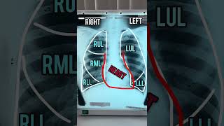 BEST WAY TO READ CHEST X-RAY