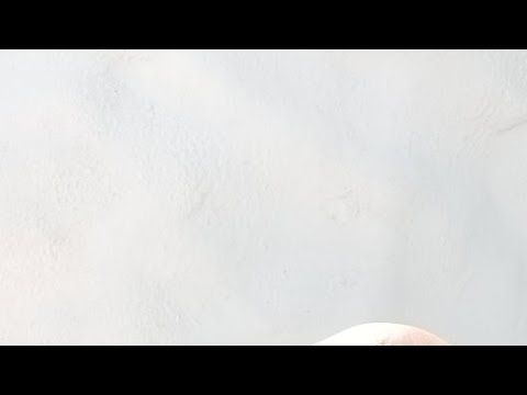 P16, LOHKO B Sm-karsinta