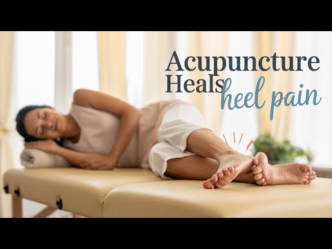 Acupuncture for Plantar Fasciitis: A TCM Healing Approach
