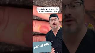 Don’t pop the blister #shorts