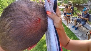 🤕 HEAD SPLIT OPEN ON HUGE SLIP-N-SLIDE - PAINFUL IMPACT CAUGHT ON CAMERA 💦