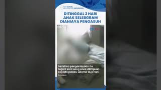 Anak Selebgram Emy Aghnia Dianiaya Pengasuhnya hingga Luka Lebam, Polisi Sudah Tangkap Pelaku