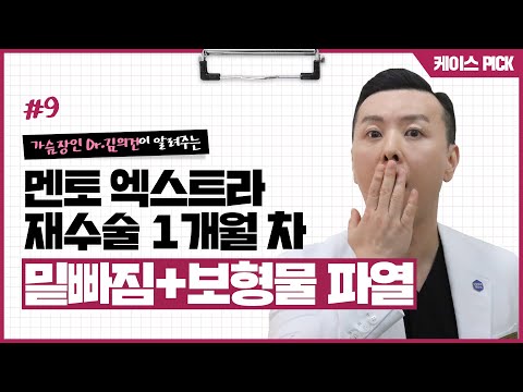 [재수술 케이스] 밑빠짐 + 보형물 파열 재수술 케이스 리뷰 | 윈느성형외과 라벨윈느 유튜브 영상