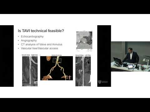 Selecting TAVI Patients - Prof Darren Walters
