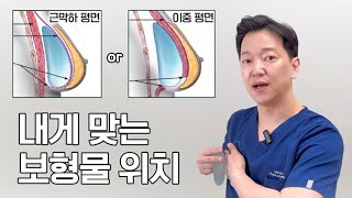 가슴수술 보형물 삽입 위치, 근막하평면, 이중평면 #디테성형외과 #이준욱원장