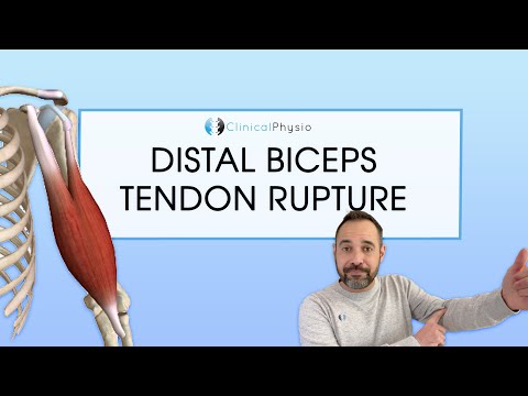Distal Biceps Tendon Rupture | Expert Physio Review