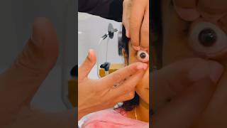 Download lagu RGP fitting #optometry #contactlenses #optometry #optometryreels #optometryeducation #education mp3