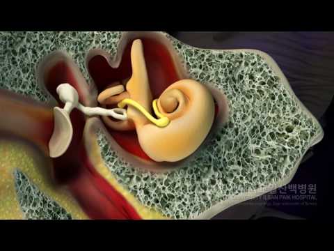 Facial nerve course 1 by JK and Cel