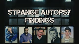 Celebrity Autopsies Shrouded in Mystery