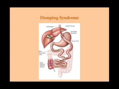 Other Gastric Disorders - CRASH! Medical Review Series