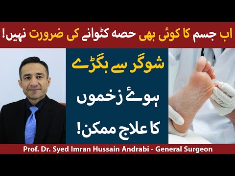 Sugar Ke Zakham Ka Ilaj In Urdu |What Is Diabetic Foot Ulcer | Diabetic Foot Ulcer Treatment In Urdu