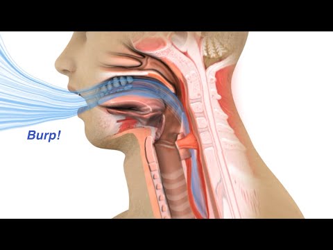 Was passiert, wenn Sie rülpsen?