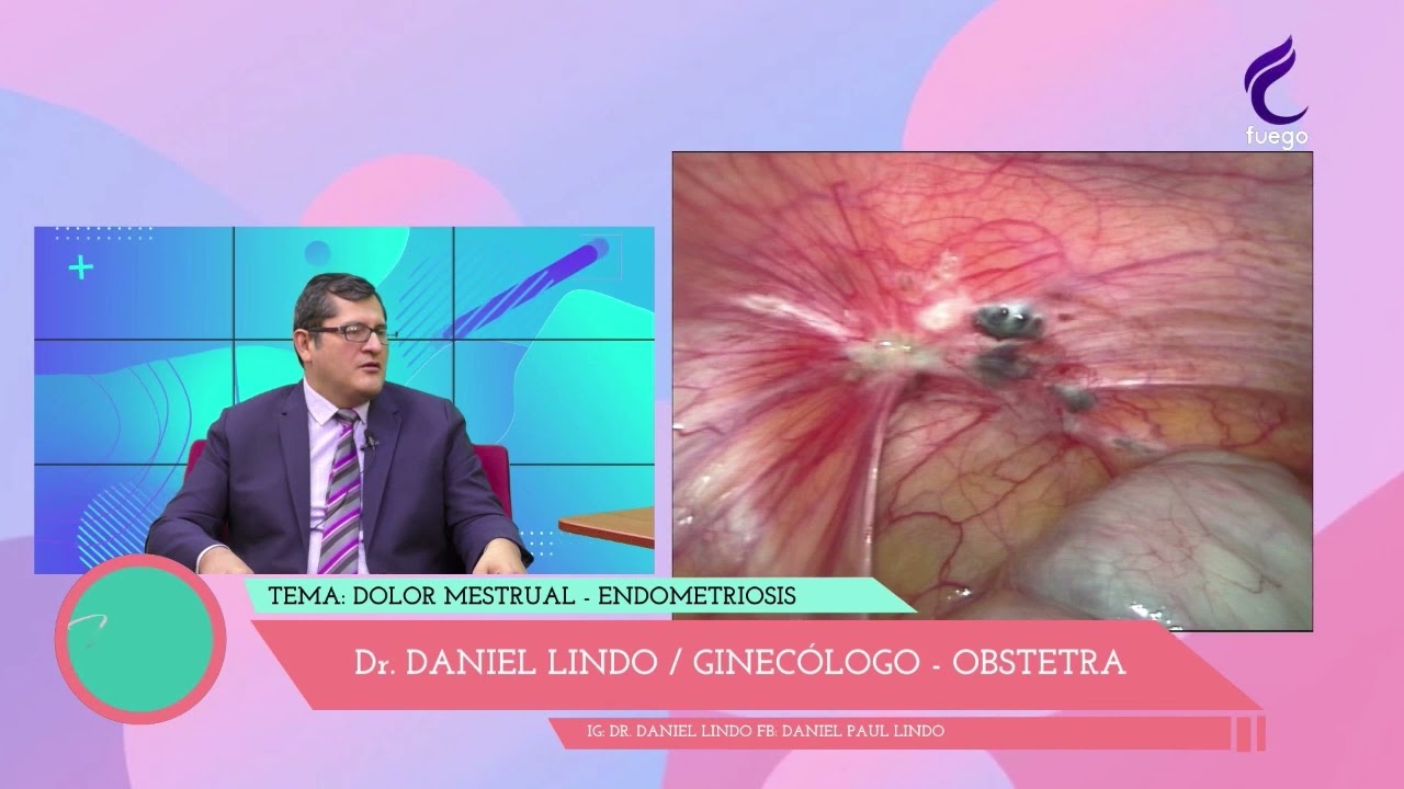 Daniel Paul Lindo Gutarra-8