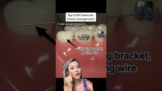 Download lagu Top 2 Tips to Fix Poky Wires on Braces at Home mp3