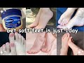 HOW I Got SOFT FEET In Just 1 Day Naturally