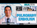 Pulmonary Embolism Etiology Pathophysiology Clinical Features Diagnosis Treatment
