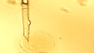 ¿Qué enfermedades se pueden tratar con células madre