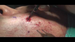 Dr. Philip Young