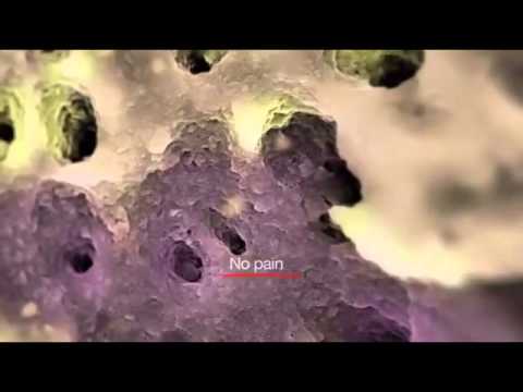 download lagu mp3 mp4 Reston Family Dental, download lagu Reston Family Dental gratis, unduh video klip Reston Family Dental