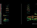 The Roches - The Anti-Sex Backlash Of The 80's : Spectrum Analysis (alto-soprano range)
