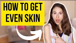 HOW TO GET EVEN SKIN TONE ON BODY | Dermatologist