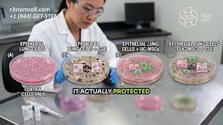 Can Stem Cell Therapy Repair Lung Damage from Smoking Dr. Greene Explains | R3 Stem Cell