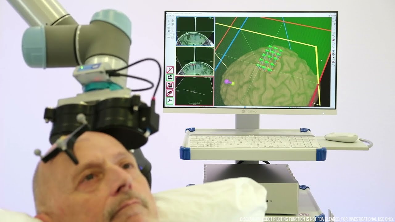 Robotized TMS with TMS-Cobot and LOCALITE TMS Navigator