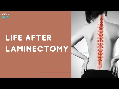 Life After Laminectomy